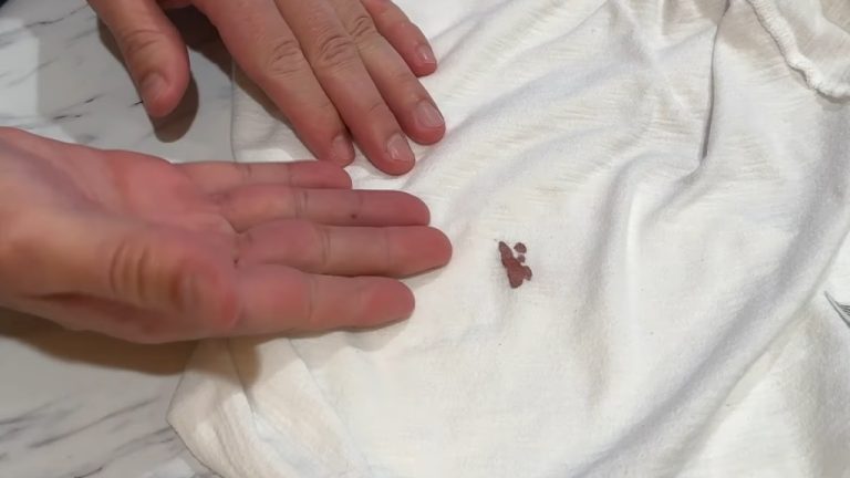 How to Get Fish Blood Out of Clothes