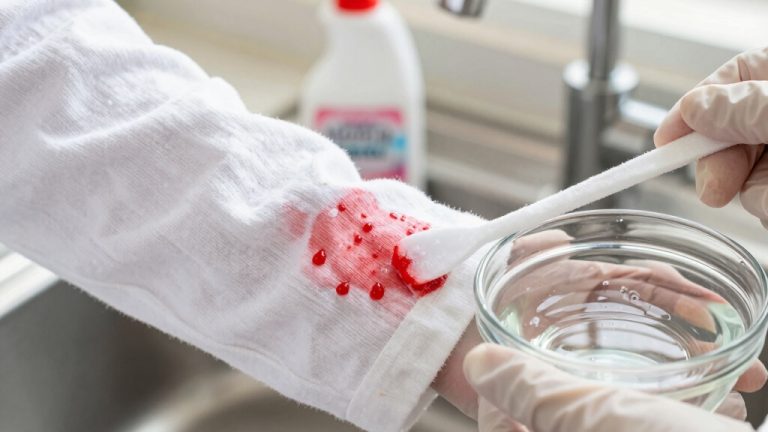 remove red food dye stains